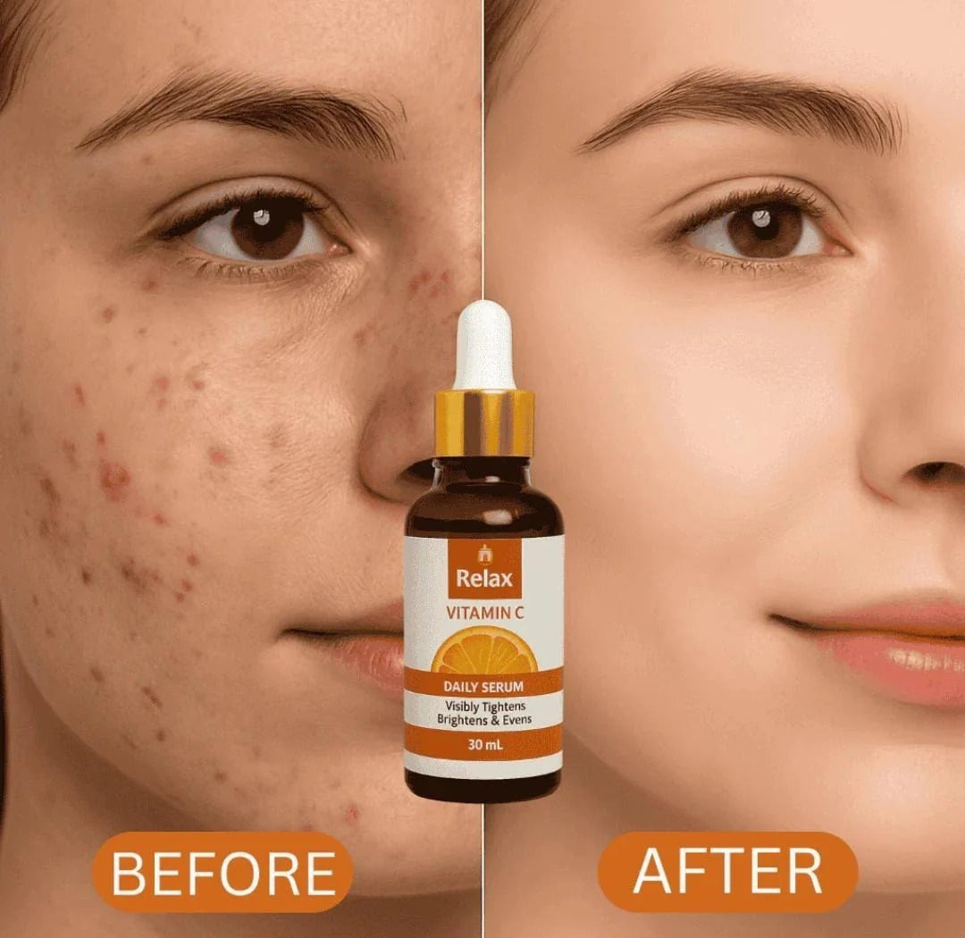 Relax Vitamin C Daily Serum - 30ml | Brightening & Anti-Aging Facial Serum
